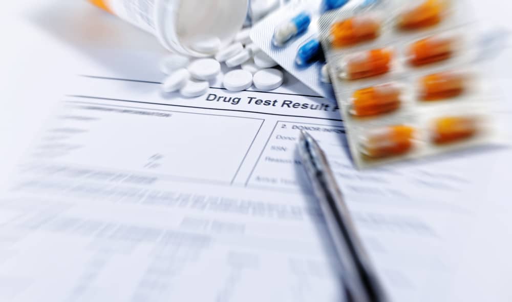 drug test result form on clipboard